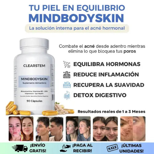 Mindbodyskin® | Reduce el acné desde la raíz y empieza a ver tu piel más limpia en la 3 semana ¡Oferta 2x1!